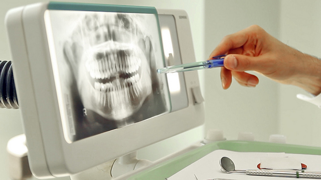 check-up-odontologico